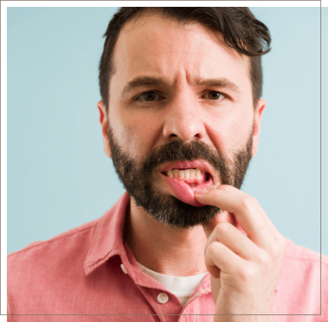 Man pointing to his red gums before gum disease treatment in Oklahoma City